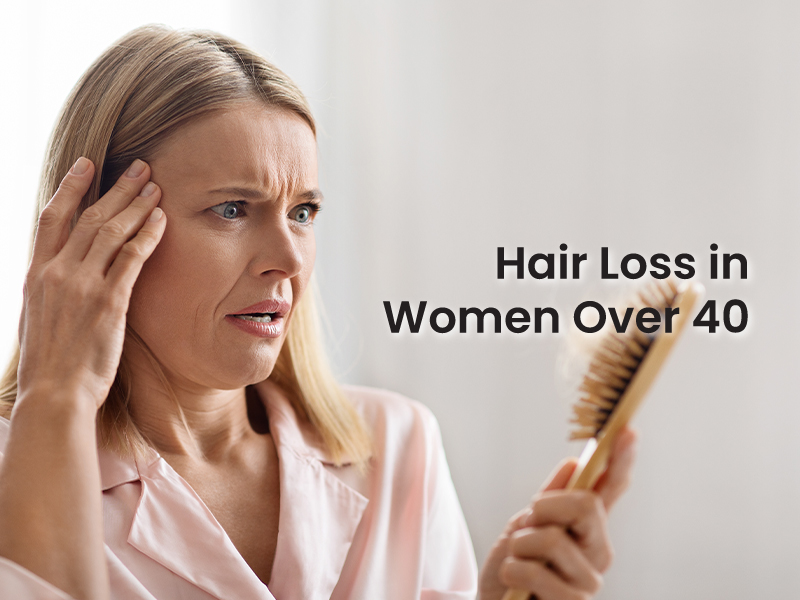 Hair Loss in Women Over 40