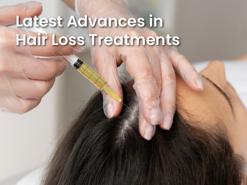 Latest Advances in Hair Loss Treatments