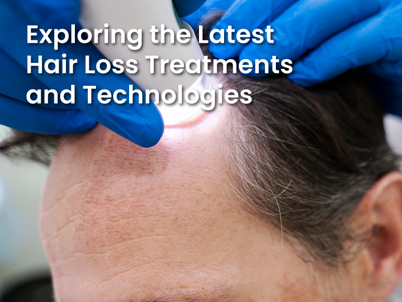 Exploring the Latest Hair Loss Treatments and Technologies