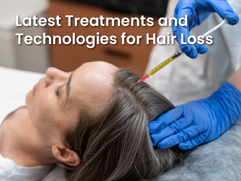 Latest Treatments and Technologies for Hair Loss