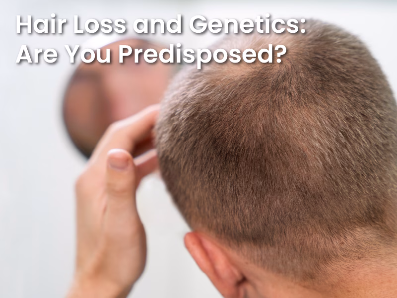 Hair Loss and Genetics: Are You Predisposed?